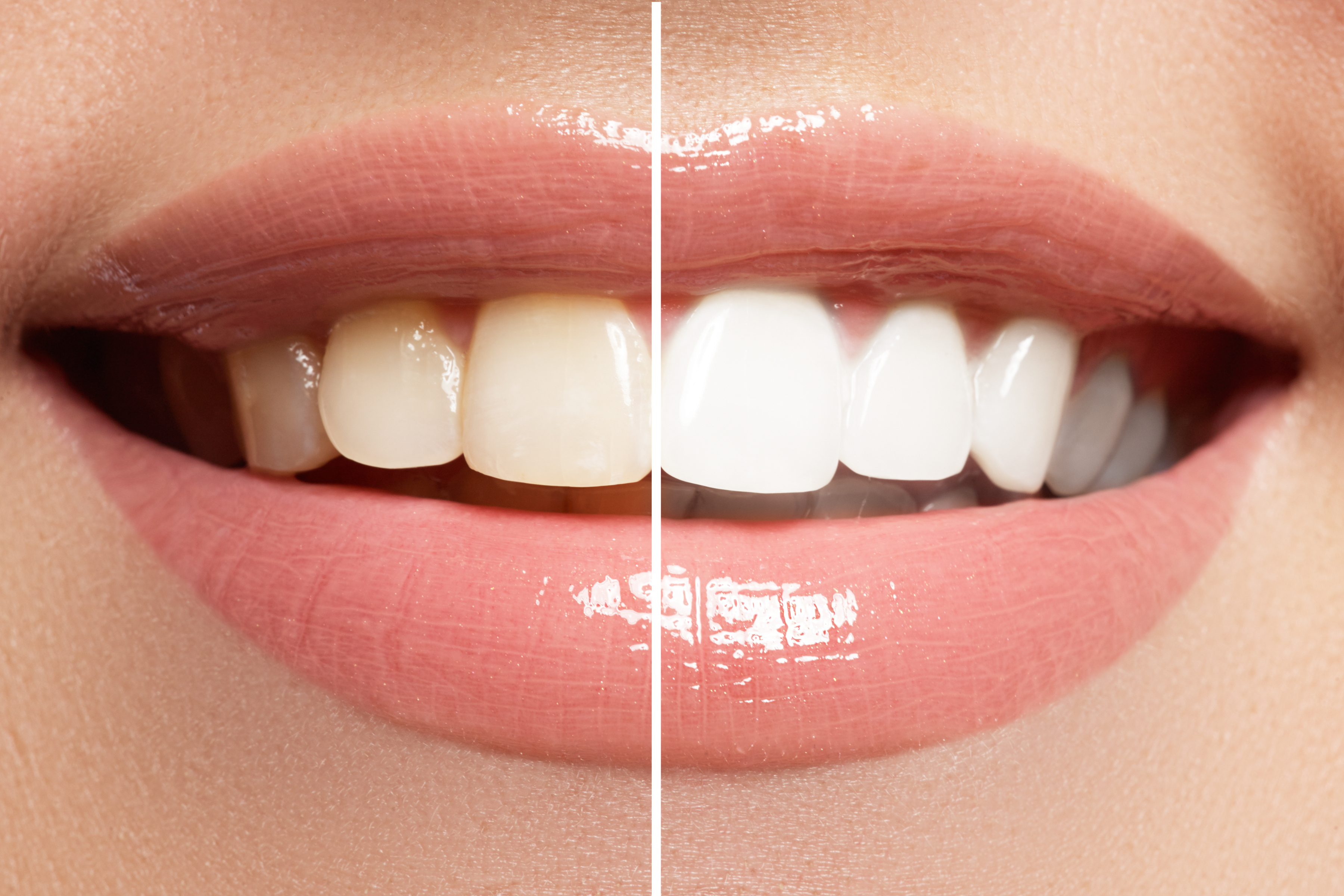 Cosmetic Dentistry